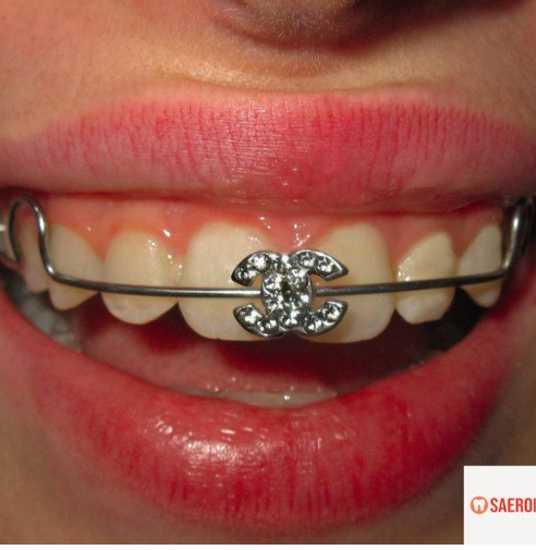 47fa9087d2a07fe32a0063268fe363e9_1743579340_9514.png 47fa9087d2a07fe32a0063268fe363e9_1743579340_9514.png