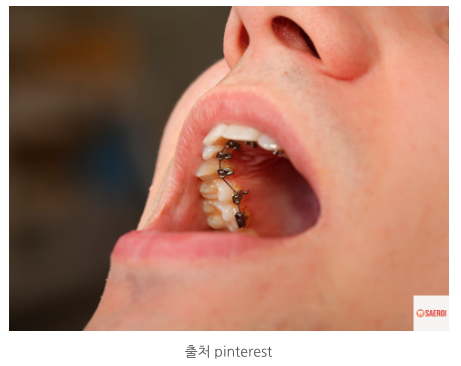 f4a32c3a9279c198fde4fac4e198e1b9_1744263739_722.png f4a32c3a9279c198fde4fac4e198e1b9_1744263739_722.png