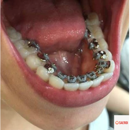 f4a32c3a9279c198fde4fac4e198e1b9_1744263894_5222.png f4a32c3a9279c198fde4fac4e198e1b9_1744263894_5222.png