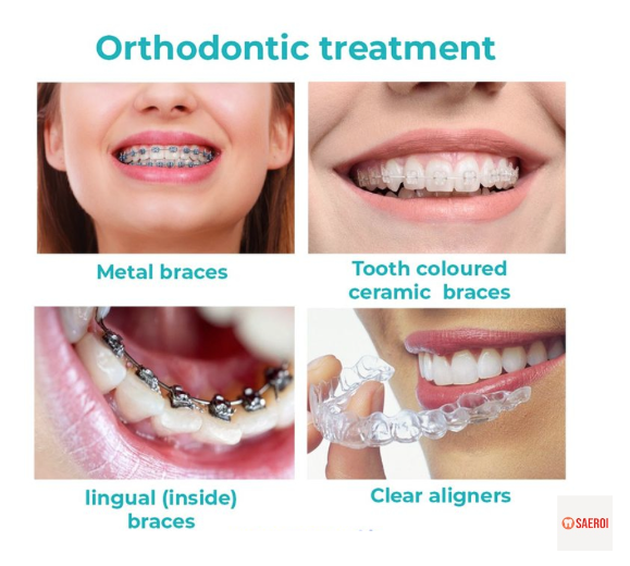 f4a32c3a9279c198fde4fac4e198e1b9_1744264908_5433.png f4a32c3a9279c198fde4fac4e198e1b9_1744264908_5433.png