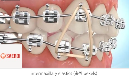 f4a32c3a9279c198fde4fac4e198e1b9_1744265729_5783.png f4a32c3a9279c198fde4fac4e198e1b9_1744265729_5783.png