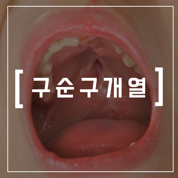 8fad817a9afa43faf2ef3edabd9340a4_1773292335_2664.png