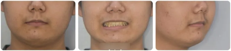 치료 종료 후 보호자 관련 사진