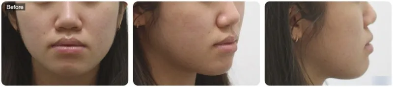 정면에서 입술이 도톰한 인상 관련 사진