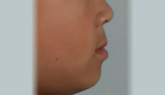 자연스럽게 개선될 것으로 기대하기보다는 정확한 검사를 통해 원인을 파악하…