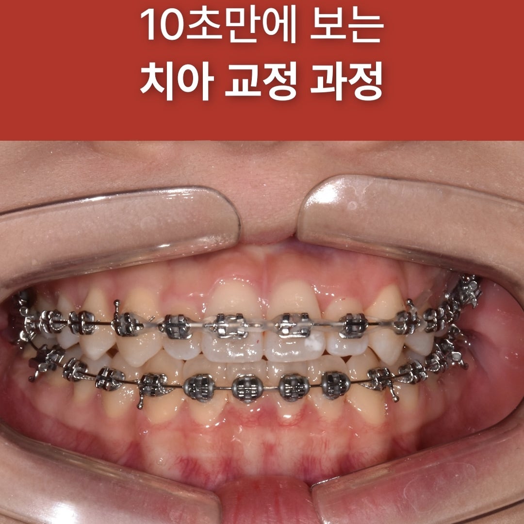 치과 증례 관련 사진