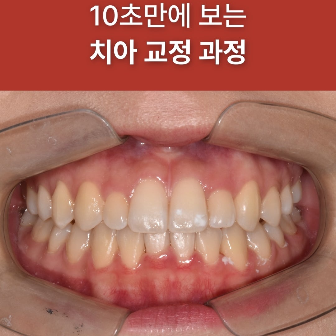 치과 증례 관련 사진