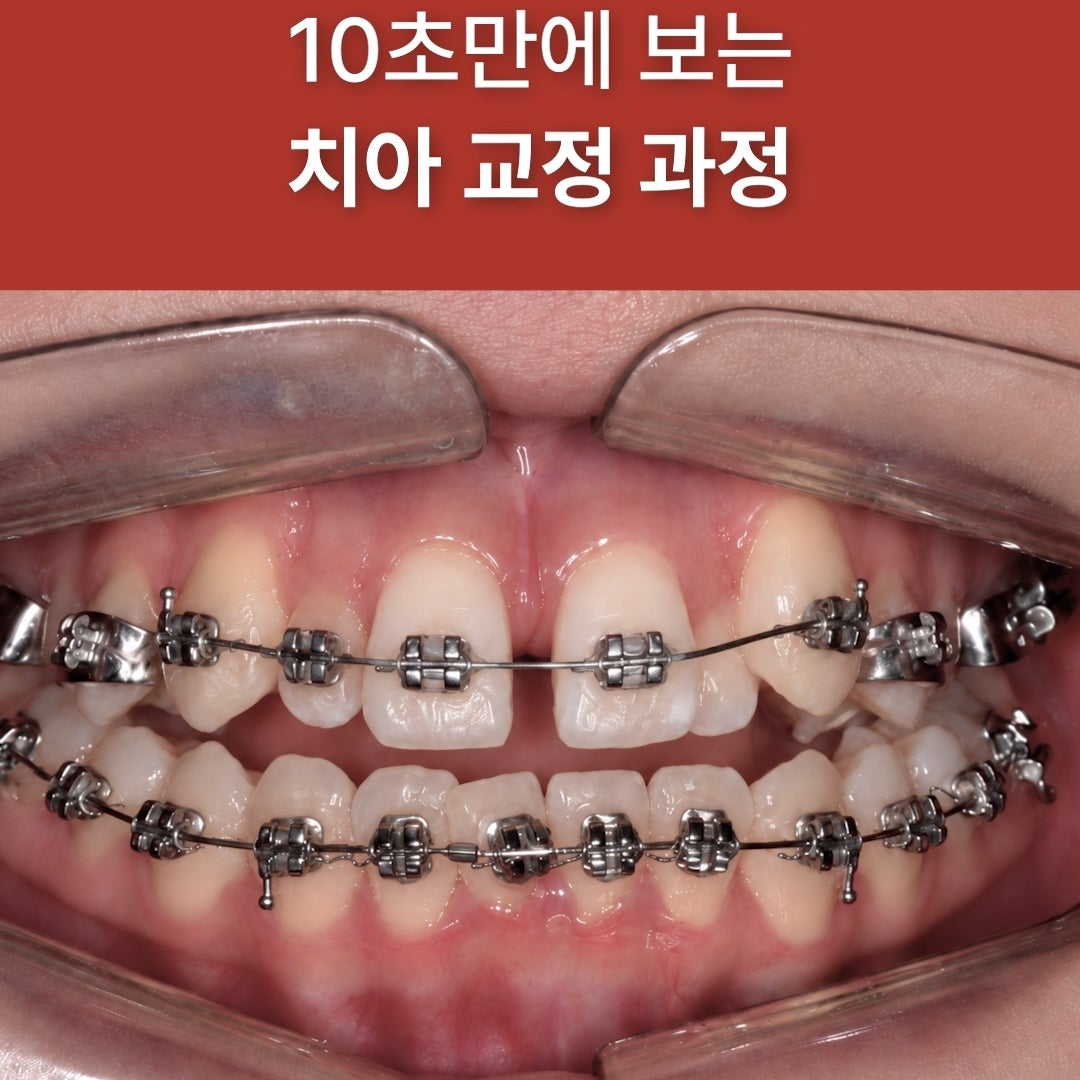 대표이미지 삭제 이전 이미지 다음 이미지