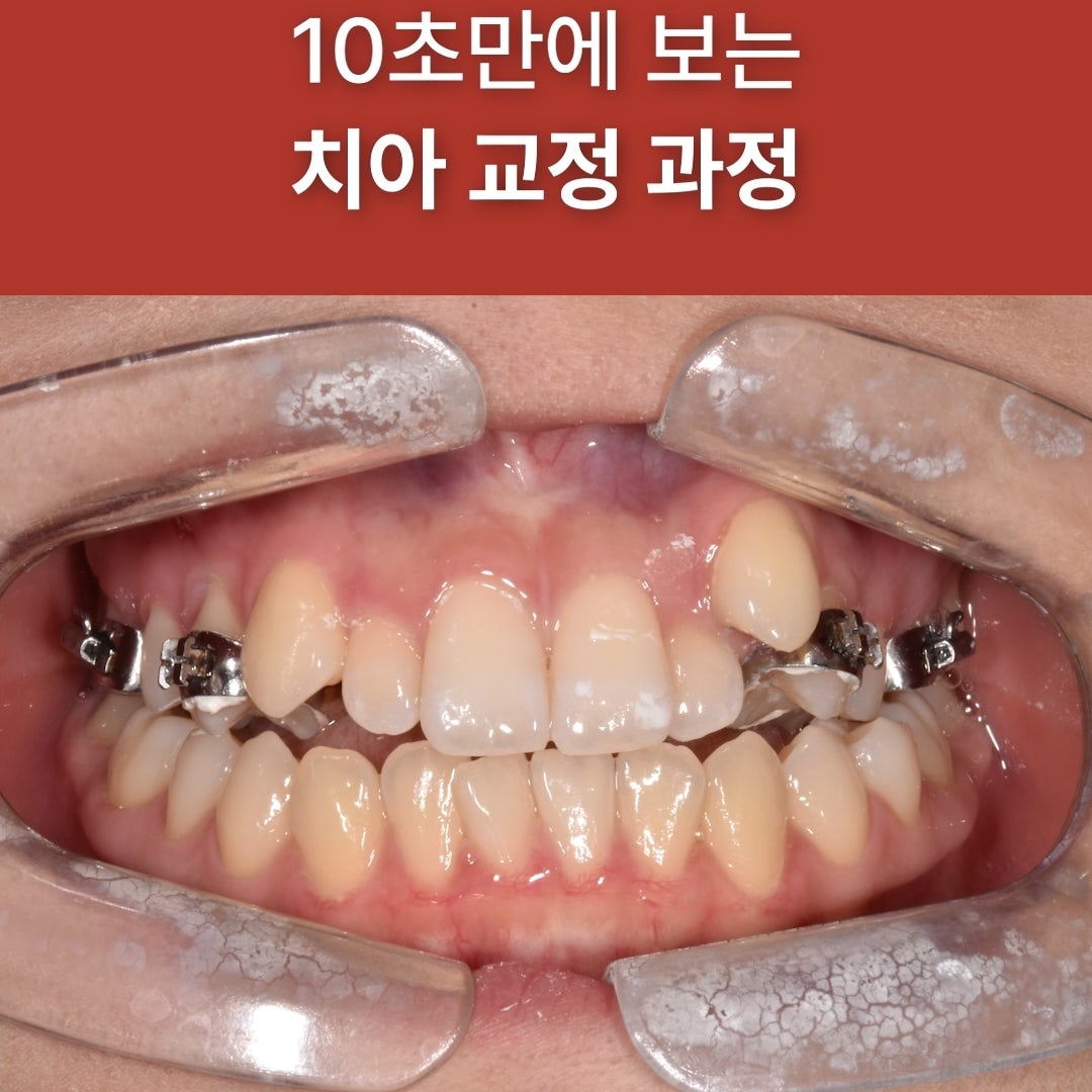 대표이미지 삭제